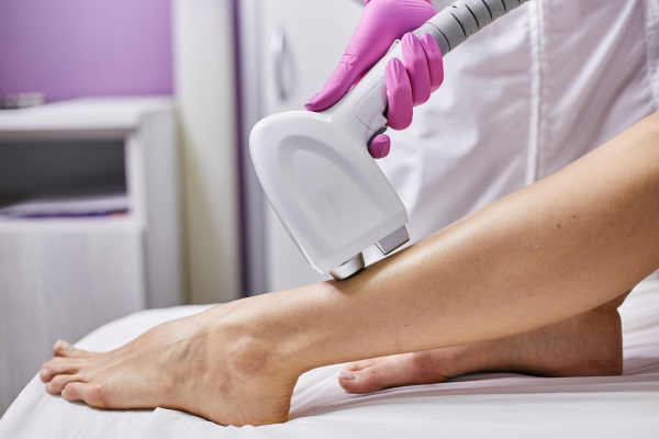 depilação a laser funciona